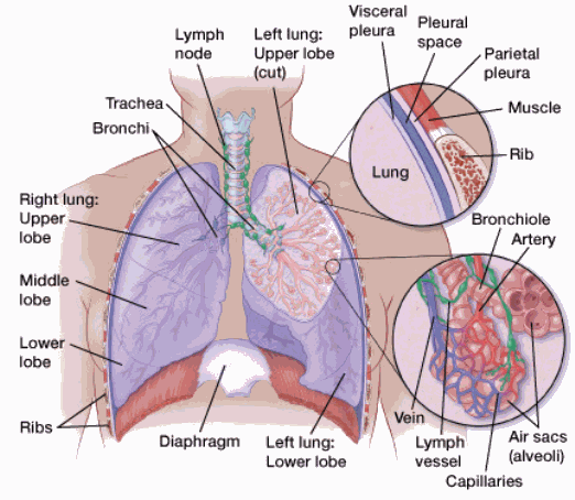 Pneumonia After Cracked Ribs