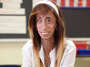 lizzie-velasquez-800